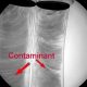 X-ray Contaminant Types Photo